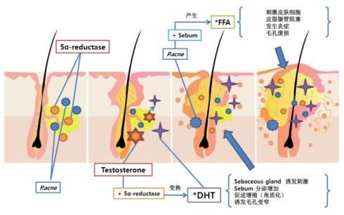 美莱医院蜂巢皮秒祛斑的优势是什么?