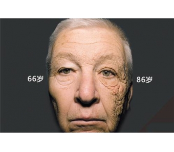 美莱医院蜂巢皮秒祛斑的优势是什么?