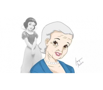 美莱医生推荐大家使用镭达光去雀斑!