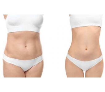 美莱医生告诉你:做双眼皮的好处有哪些!