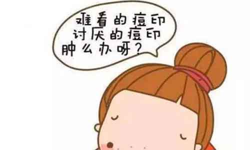 上海美莱告诉您关于收缩毛孔的真相