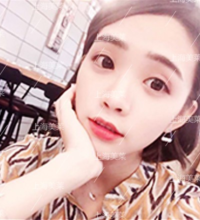 上海美莱告诉您关于收缩毛孔的真相