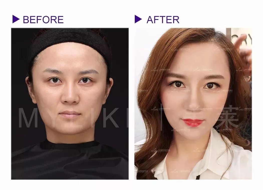 【<a href='/' target='_blank'><u>上海美莱</u></a>自体脂肪隆胸】从小胸到大胸,你会经历……