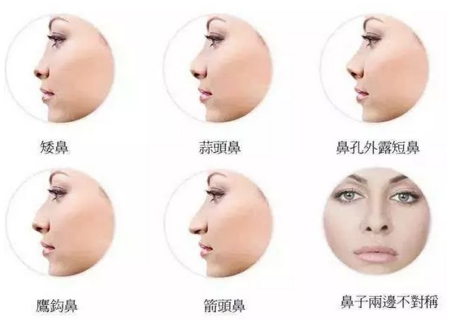 上海美莱科普|上海割双眼皮多少钱？疼不疼？