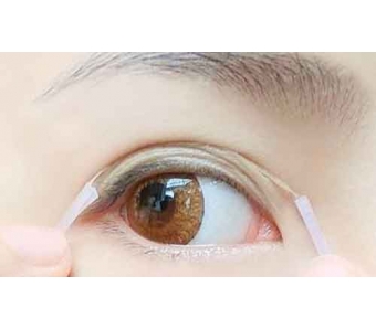 激光祛斑一般需要做几次?美莱医生科普!