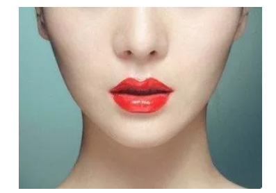 美莱医生给您科普:耳软骨隆鼻的优势是什么?