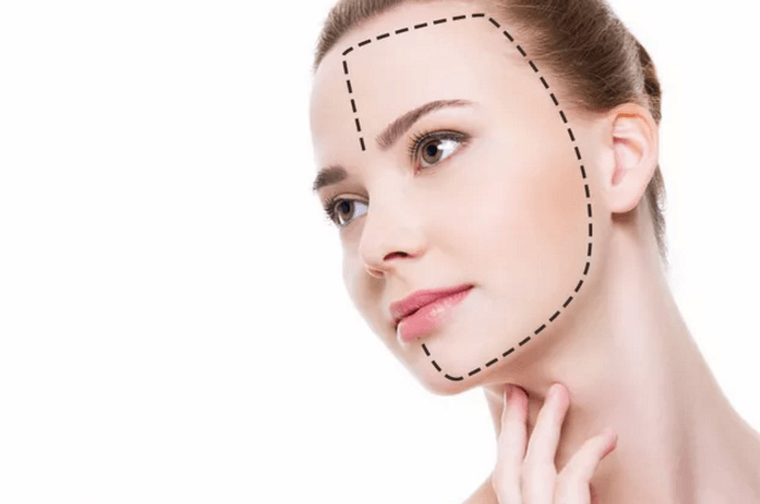 变美鼻子做隆鼻手术安全吗,美莱如何看!