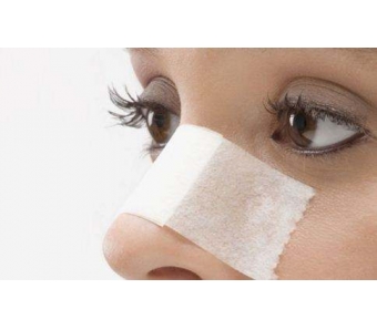 变美鼻子做隆鼻手术安全吗,美莱如何看!