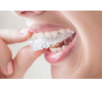 美莱医生告诉你:如何预防和消除痘痘!