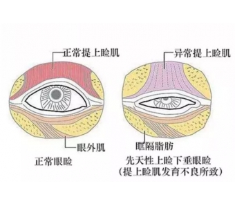 有什么好的减肥方法?美莱吸脂可以帮你做到!