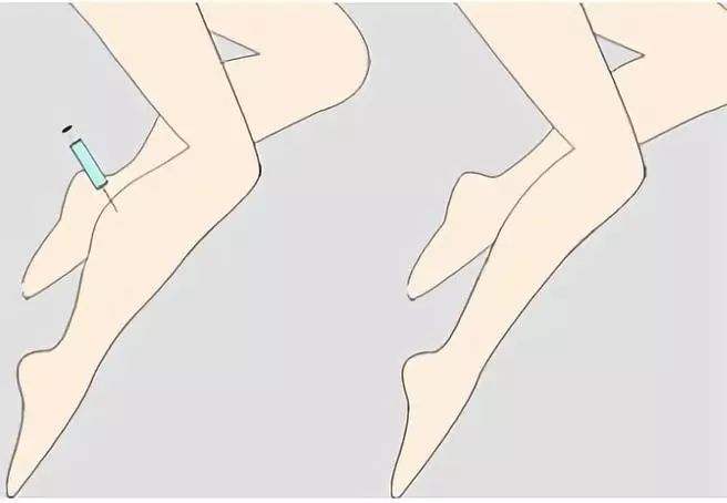 有什么好的减肥方法?美莱吸脂可以帮你做到!