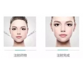 美莱医生告诉你:开眼角后要注意什么?