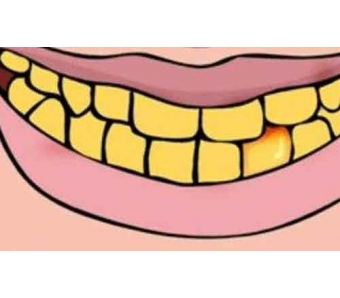 美莱告诉你:开外眼角疼吗?