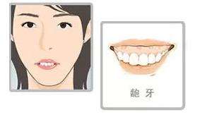 美莱全切双眼皮适合哪些人来做?