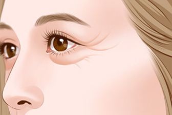 美莱医生告诉你:鼻翼缩小术有后遗症吗?