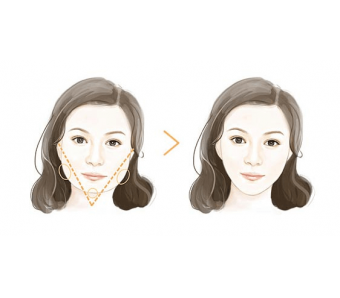 上海美莱美容科普！我们割双眼皮失败能修复吗