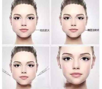 上海美莱王琳说—作自体软骨隆鼻失败还可以再修复吗