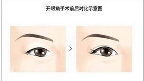 美莱医生告诉你:如何预防老年斑的出现!