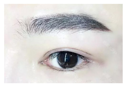 上海美莱|为什么隆鼻却看不到伤口?