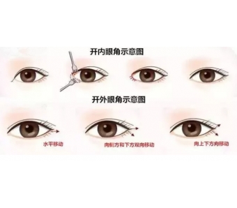 <a href='/' target='_blank'><u>上海整形医院</u></a>美莱为我们讲解：脸上脂肪填多了怎么办