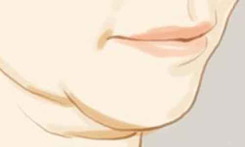 做开眼角手术会不会有副作用呢?上海整形医院?