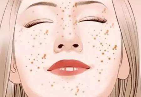 美莱有美白嫩肤的有效方法吗?