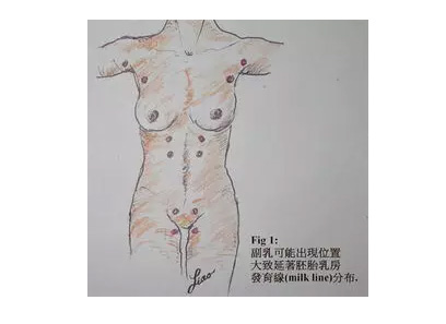 上海做祛斑哪家好,美莱告知男人脸上长斑什么原因?