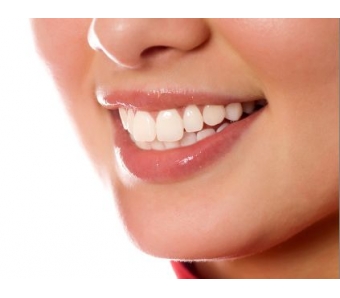 美莱黄金皮秒祛斑,防止反黑!