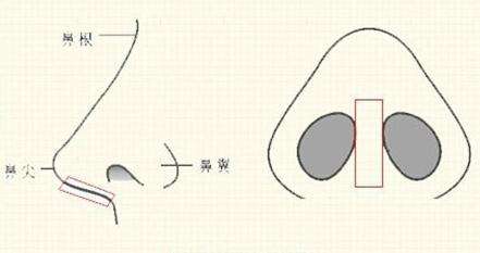 美莱黄金皮秒祛斑,防止反黑!