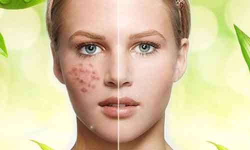 做双眼皮后还能做开眼角吗?美莱科普!