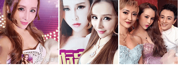 上海做假体隆胸的安全吗?有没有后遗症发生?