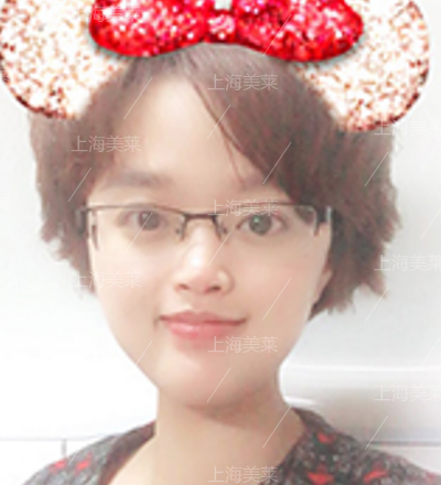 美莱瘦小腿有效的方法是什么?