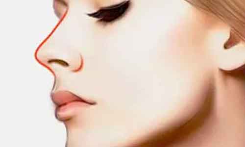 上海做双眼皮|你真的适合“欧式”双眼皮吗？