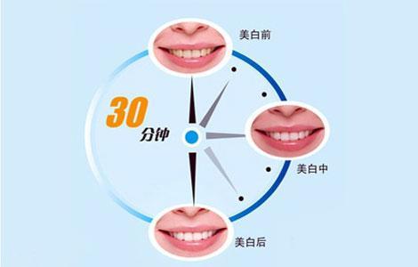 上海做鼻形矫正适应症有哪些