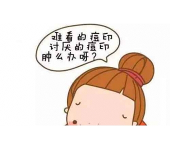 割双眼皮的常见误区，杜医生告诉你靠谱的