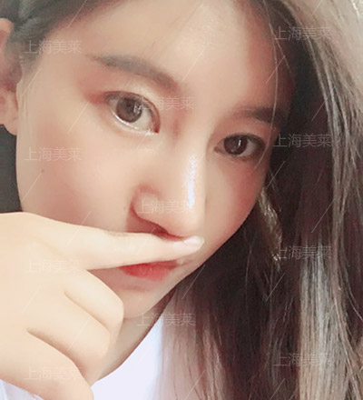 <a href='/' target='_blank'><u>上海美莱</u></a>美容医院