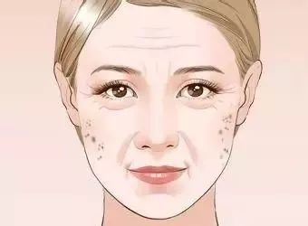 隆鼻后,鼻子会一碰就歪么