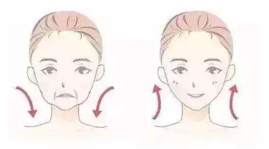 美莱丰苹果肌之后,给整张脸带来了怎样的变化?