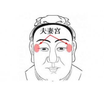 上海注射瘦脸针时间是多久,效果是终身的吗?