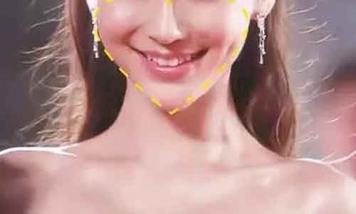 毛孔粗大怎样改善?美莱