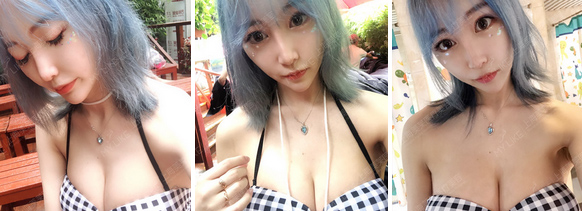 做完假体隆胸后，睡姿要注意什么吗