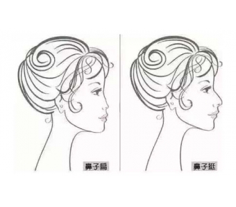 美莱医生告诉你:什么是开眼角和开眼角的恢复期!