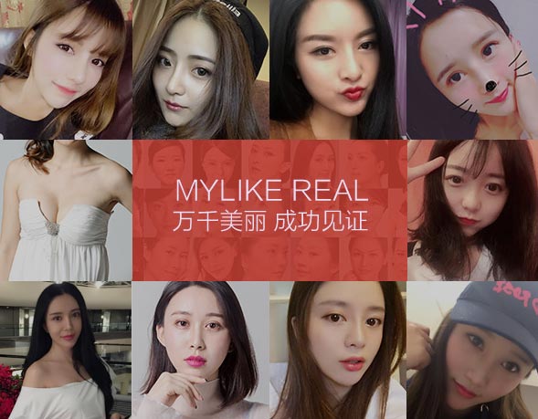 填充泪沟自体脂肪和玻尿酸的区别是什么?