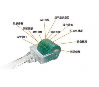 埋线双眼皮的优势有哪些?