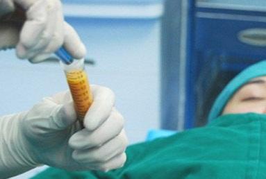 腿部吸脂有什么后遗症?