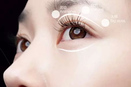 上海割双眼皮要打麻醉吗?