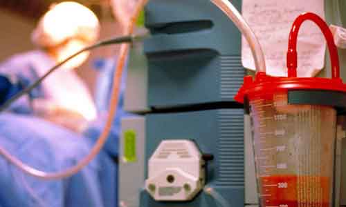 之前做过双眼皮还能做吗?隔多久可以做第二次?