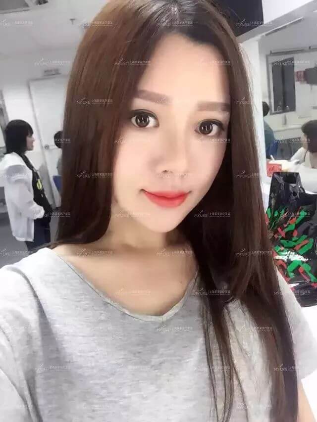 上海牙齿冷光美白为什么会变黄?