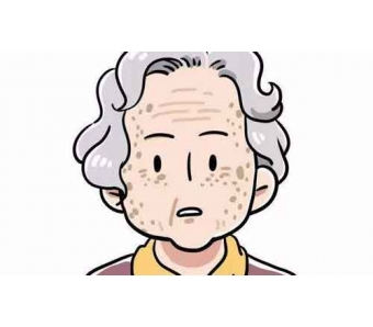 上海冷光牙齿美白的原理是什么?