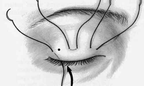 上海打完瘦腿针可以运动吗?多久可以运动?